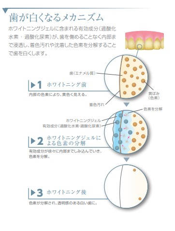 歯が白くなるメカニズム